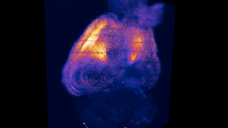 This Is What Cocaine Addiction Looks Like In a Transparent Mouse Brain